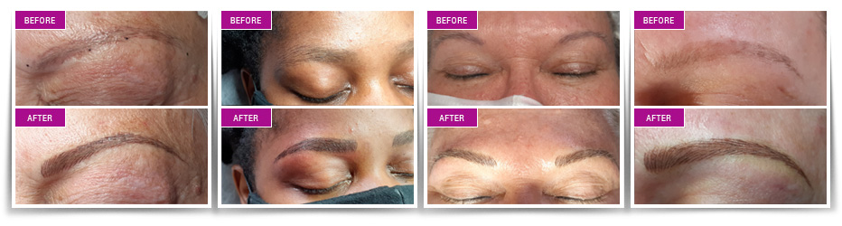 Microblading