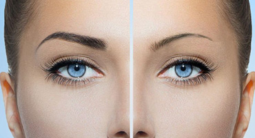 Microblading